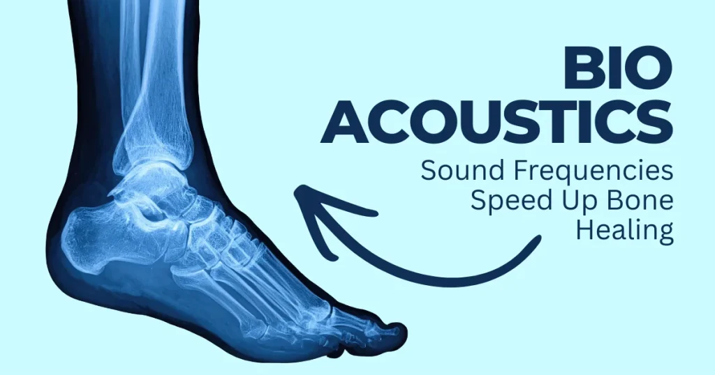X-ray of a human foot and ankle showing Bio-Acoustics technology for speeding up bone healing with sound frequencies.