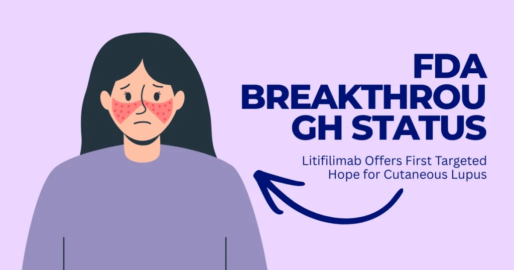Illustration of a woman with a malar lupus rash and text announcing FDA Breakthrough Status for Litifilimab for Cutaneous Lupus.