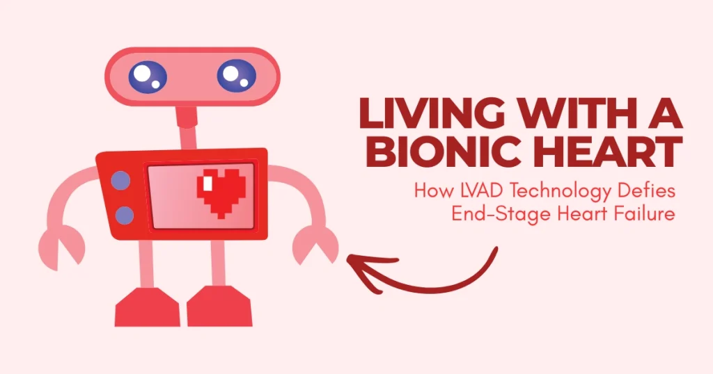 A medical illustration showing a human heart with a mechanical LVAD pump attached to the left ventricle, with a driveline exiting the abdomen to an external controller.[Bionic Heart]