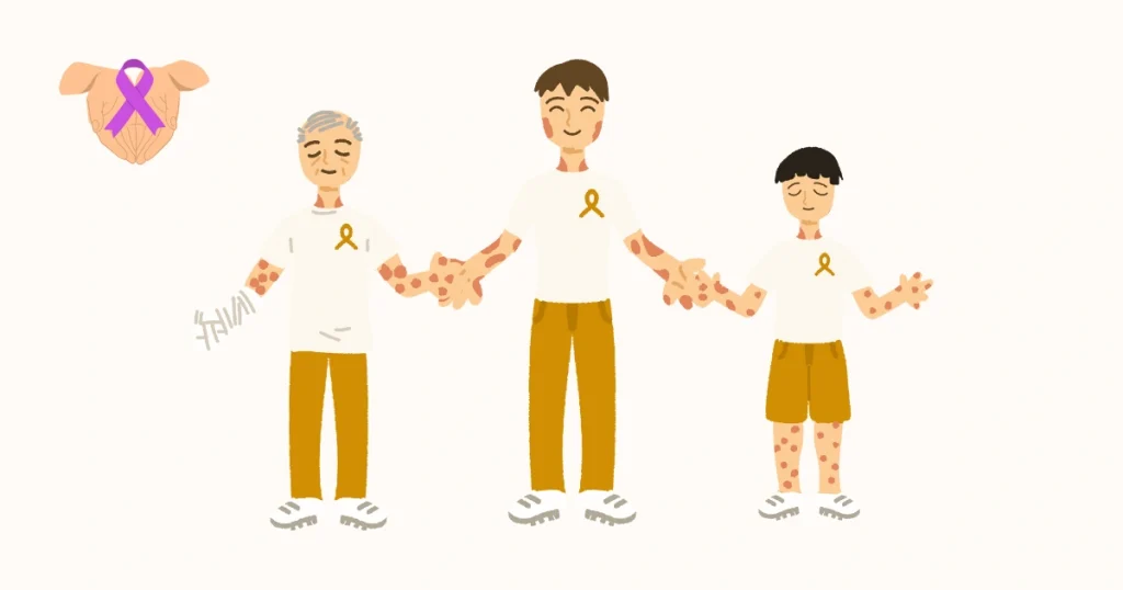 Managing Leprosy Reactions