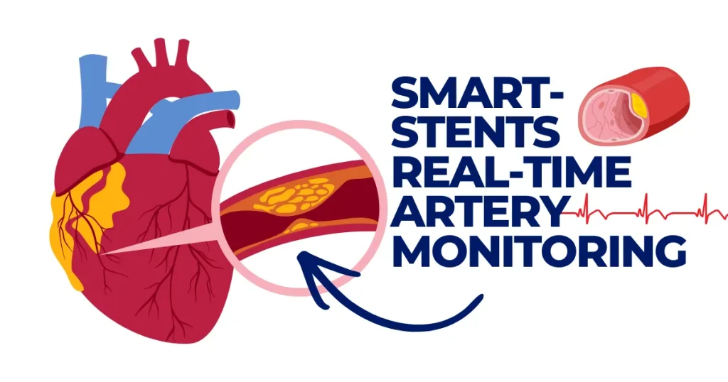 Smart-Stents | Real-Time Artery Monitoring Smart-Stents | Diagram of a human heart and artery illustrating a smart stent for real-time monitoring of arterial plaque and blood flow.