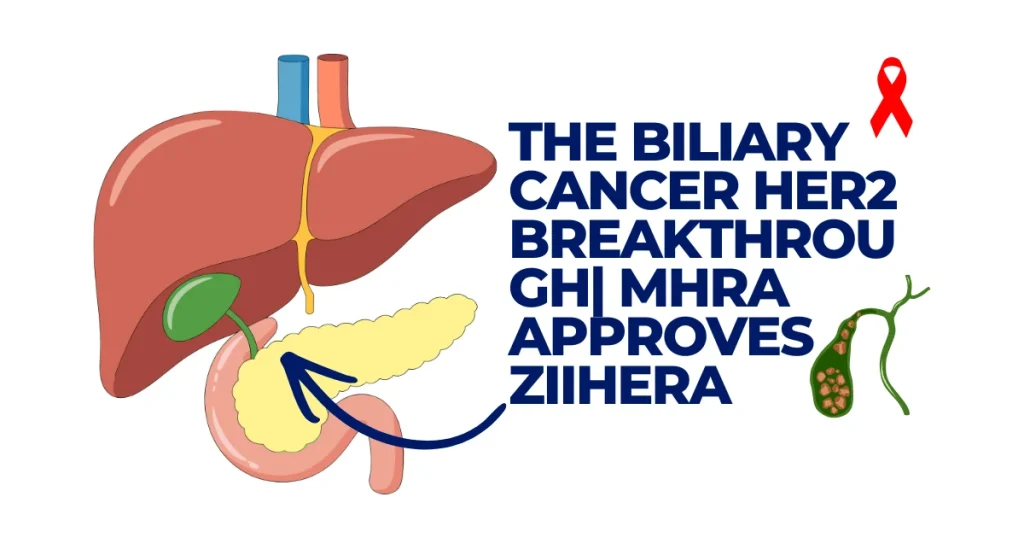 Medical illustration of the liver and pancreas alongside text announcing MHRA approval of Ziihera for HER2-positive biliary tract cancer. Biliary Cancer